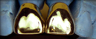 gold crown